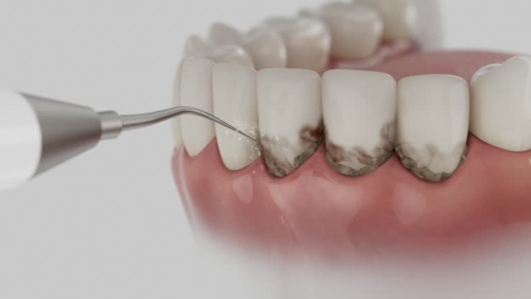 Trusted Dental Implants service in Waverly, IL - Dentist Open Now